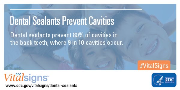 Dental sealants are clear coatings applied to children’s molars, which are the most cavity-prone teeth. Help us raise parents’ awareness about the benefits of getting sealants. 
