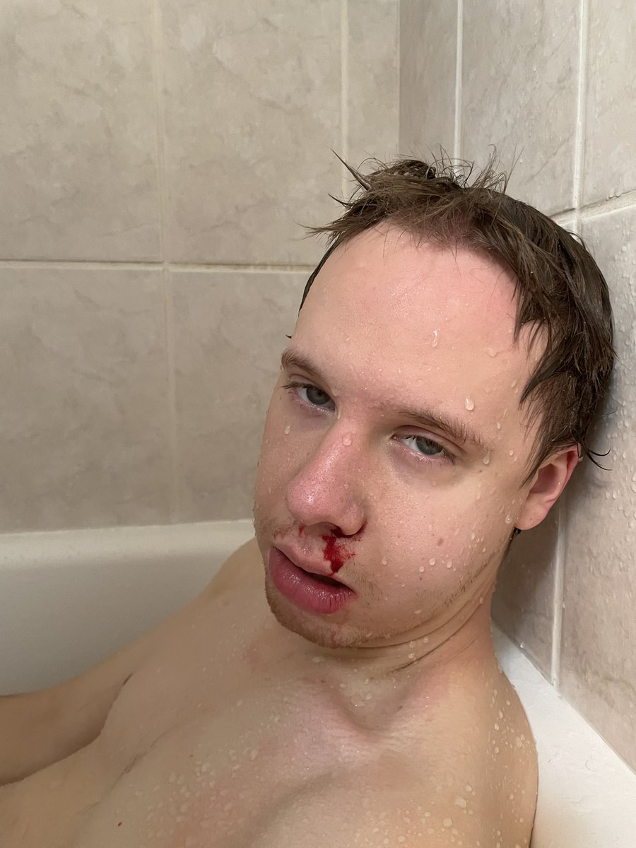 Ballistic_Ninja's tweet photo. Living my best life post surgery ✨✨✨ https://t.co/uQXd3lNAJE