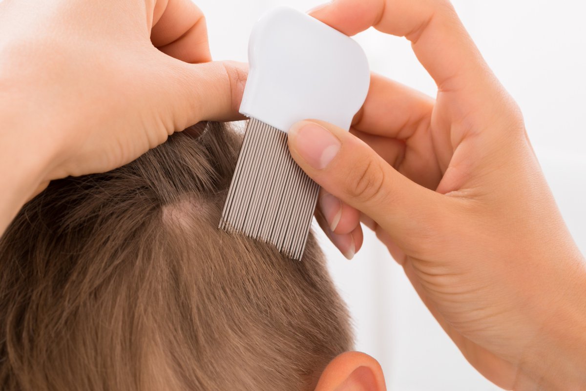 New guidance for #headlice in #schools from <a href="/AmerAcadPeds/">American Academy of Pediatrics</a> lists several treatment options and reiterates that forcing a child with lice to stay home may do more harm than good. AAP and NASN suggest discontinuing “no-nit” policies. 
ow.ly/HkoF50L38fX #liceeducation
