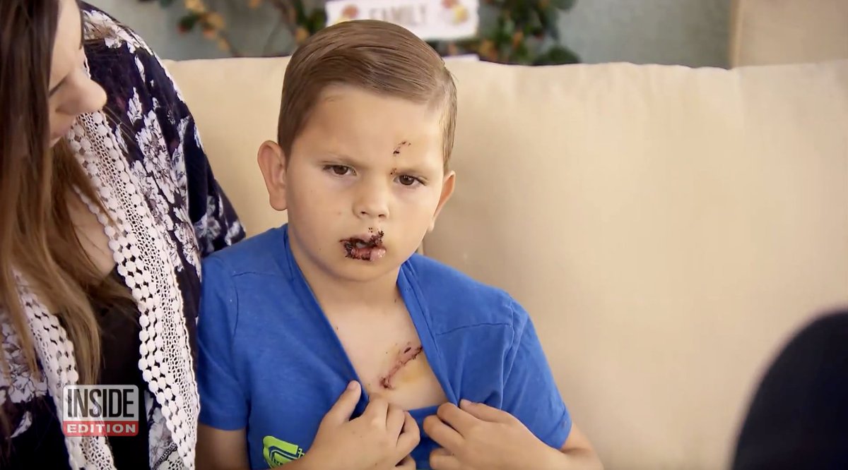 Inside Edition on Twitter "1/ An 8yearold boy is recovering from a