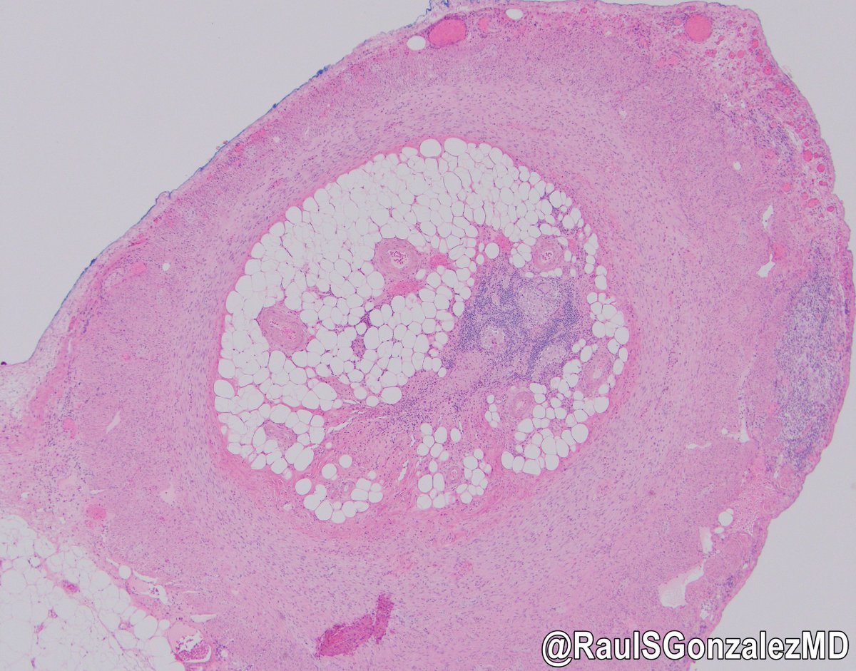 Raul S. Gonzalez, MD tweet media