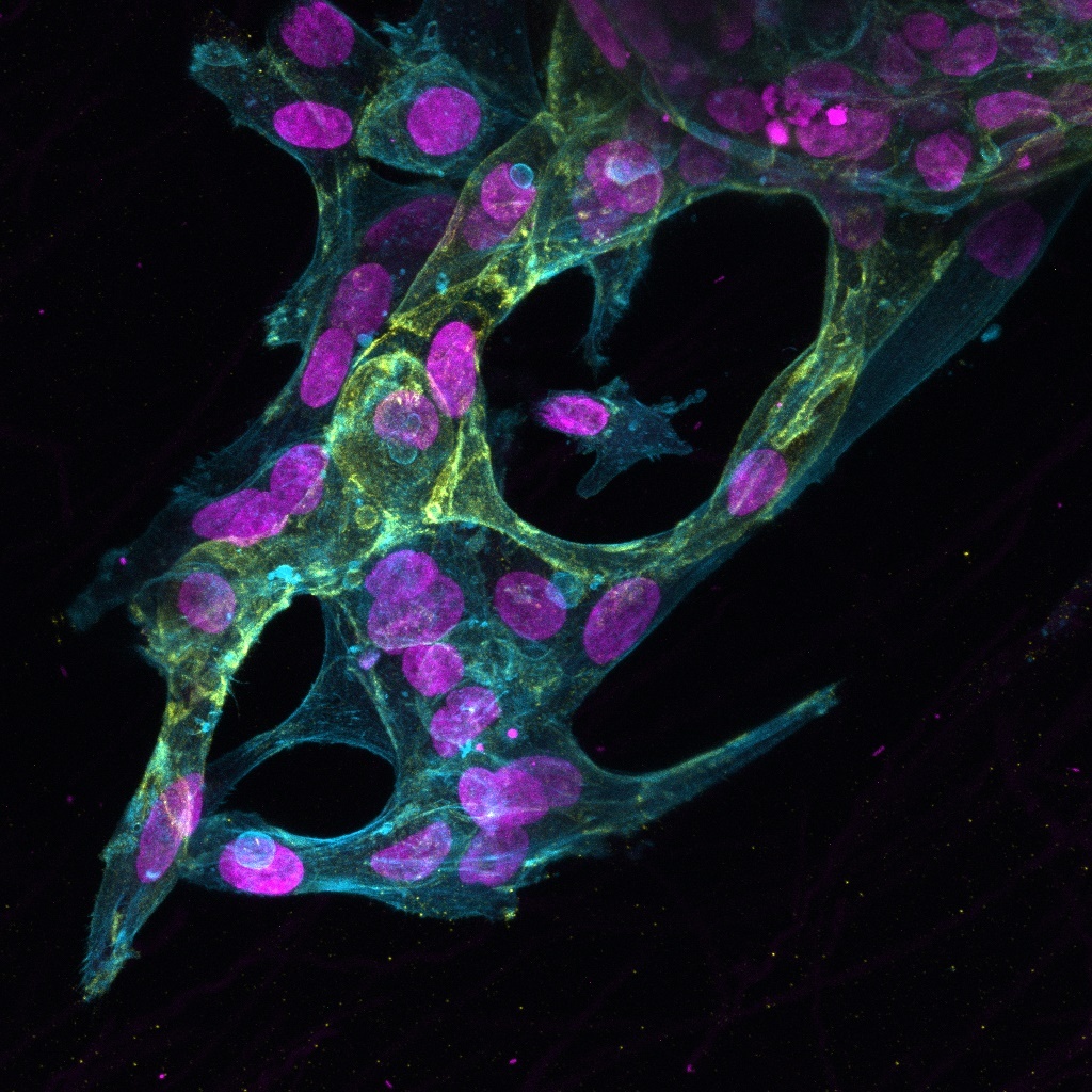 "The most important factor in survival is neither intelligence nor strength but adaptability." Check out Harrison's work on cellular adaptations to matrix stiffness and fiber density that result in a diversity of migratory modes.  authors.elsevier.com/a/1fvZ66CFjZMP…