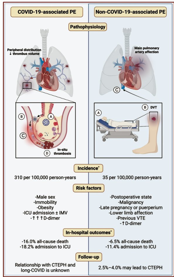 #COVID19 Associated Pulmonary Embolism: Review of the Pathophysiology, Epidemiology, Prevention, Diagnosis, and Treatment @LHCHFT @LJMU_Health @LivuniILCaMS @LivHPartners thieme-connect.de/products/ejour…