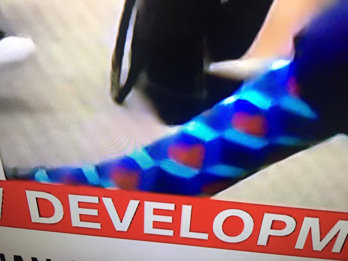 jeffwilkin1's tweet photo. Love chuck Shumer’s rocking color socks!!!!! https://t.co/4PE8DlBaS4