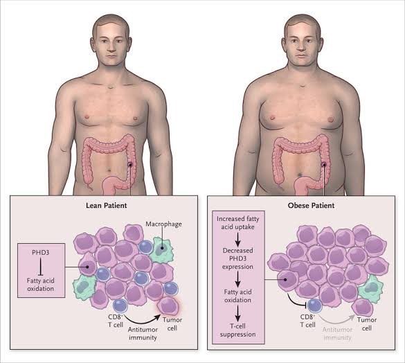 DrMijailTapia's tweet photo. El aumento de la grasa corporal, particularmente la visceral, se asocia a cambios que suprimen el sistema inmunológico, aumentando a su vez el riesgo de distintos tipos de cáncer 🧫 https://t.co/ticTmXDnlI