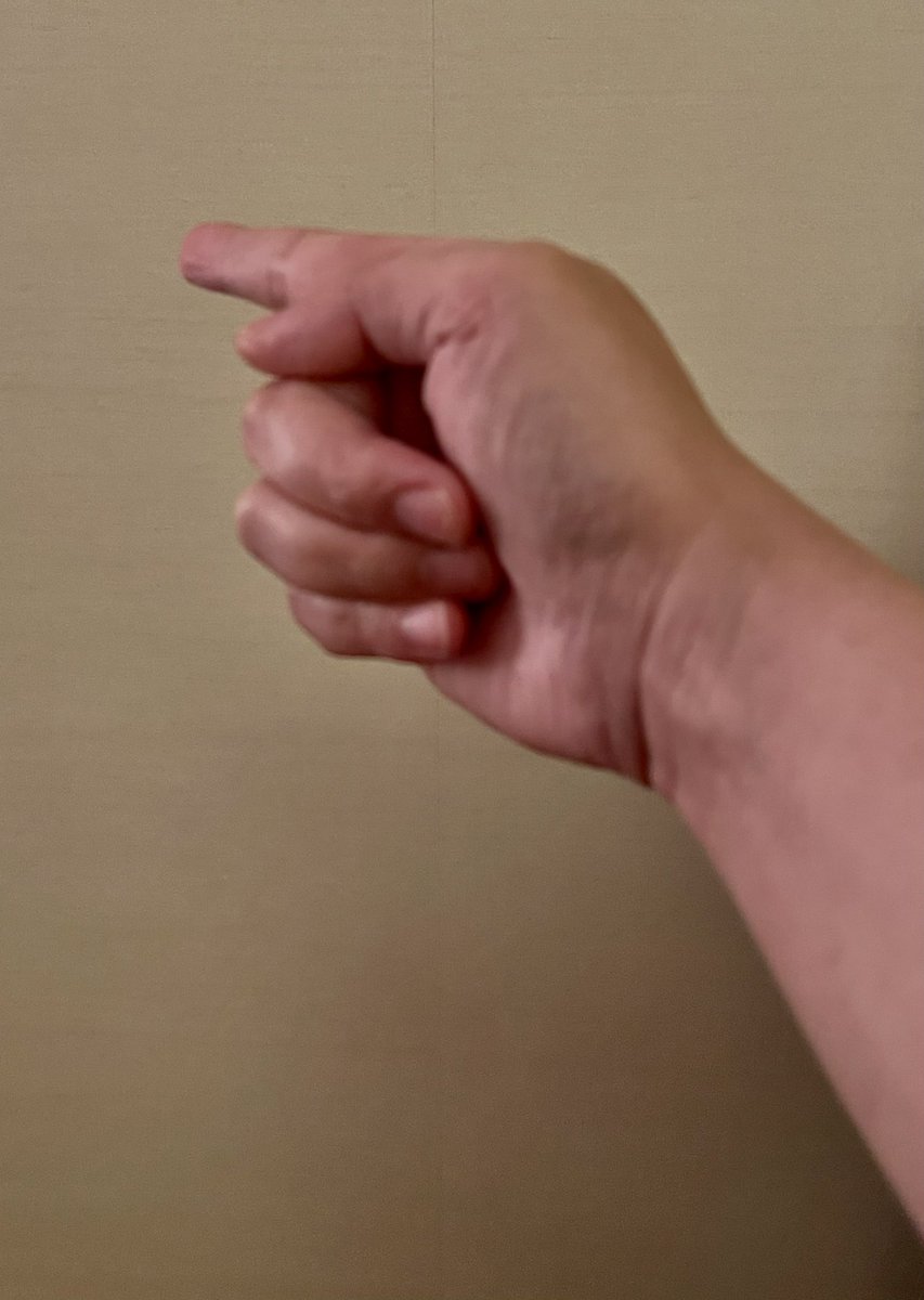 พรุ่งนี้ไม่ว่าสถานการณ์จะเกิดอะไรขึ้นผมเชื่ออย่างเต็มใจว่าความสูญเสียในครั้งนี้ ถ้าเราเลิกชี้นิ้วเเล้วหันกลับมามองตัวเองทุกท่านจะเห็นเนื้อแท้ของสังคมไทยที่ไร้ซึ่งฝักฝ่ายทางการเมือง “เวลาเราชี้นิ้วเข้าหาใคร…..อย่าลืมว่าอีก 3 นิ้ว (กลาง นาง ก้อย) คือเข้าหาตัวเอง #รวมพลังใจทั้งชาติ