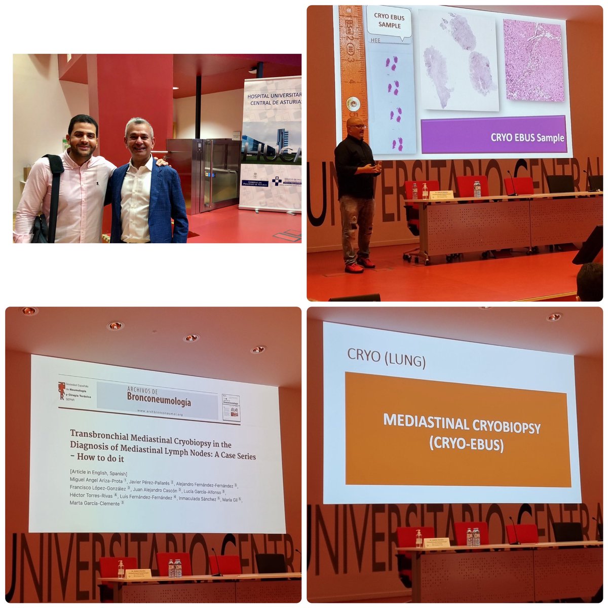 MiguelAriza83's tweet photo. Gracias al Dr. H. Rivas @duckhuca y a todo el servicio de Anatomía Patología por invitarme a participar en una jornada magnífica #PINA2022 hoy en el @HUCA_Asturias @USFNA_SPAIN y compartir nuestra experiencia en #cryoEBUS @jpallaresneumo junto al gran Dr. Chandra @AshishC97225686 https://t.co/Ty7bpCUIgm