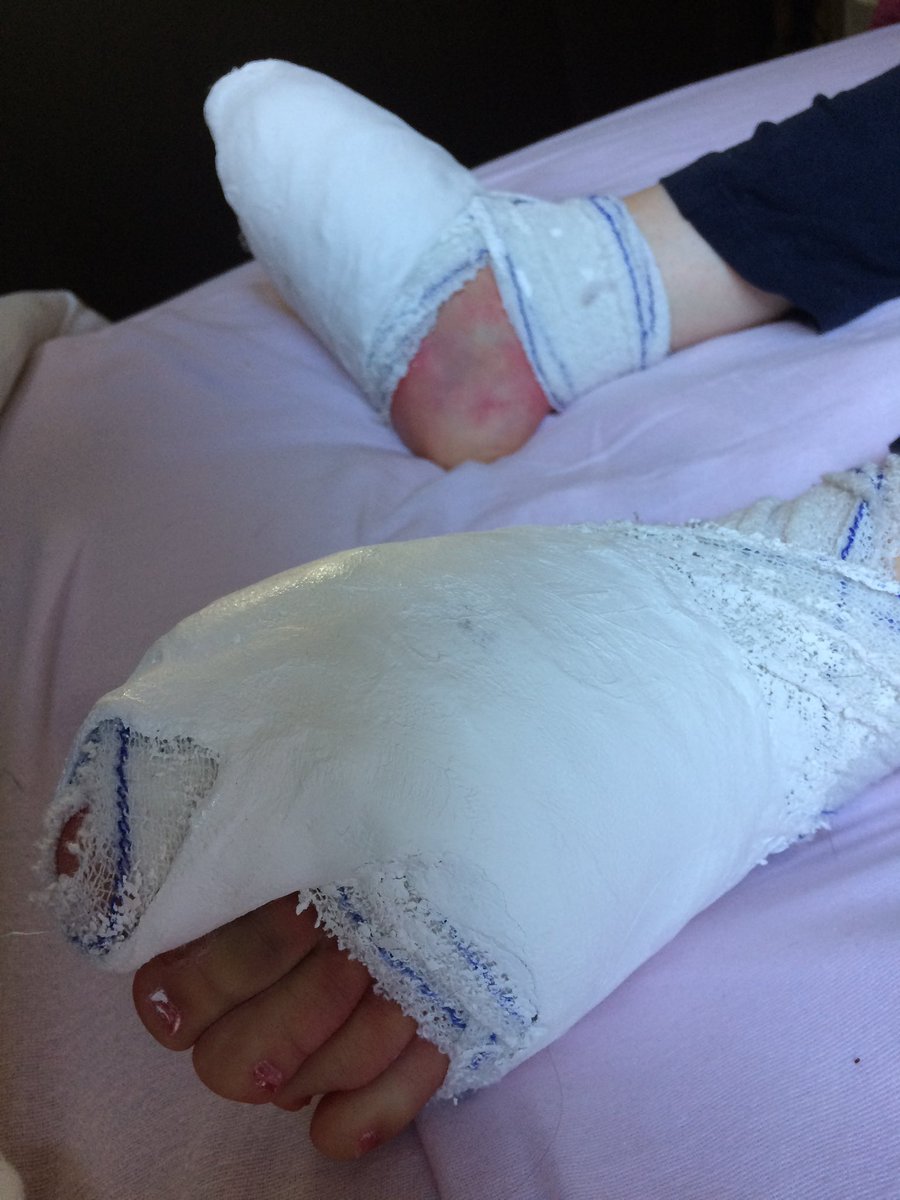 RollingMegan's tweet photo. Happy #WorldCPDay everyone. It’s not always easy but I wouldn’t change it for the world. Yes, I’ve had a few battle wounds, but I’m #stillhere and #stillhappy https://t.co/2dV5tsjGFI