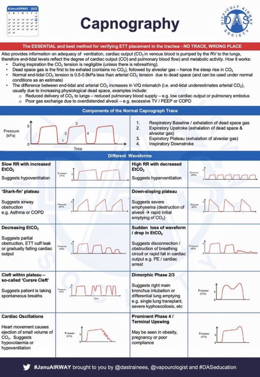 Capnography overview #MedEd #Medtwitter