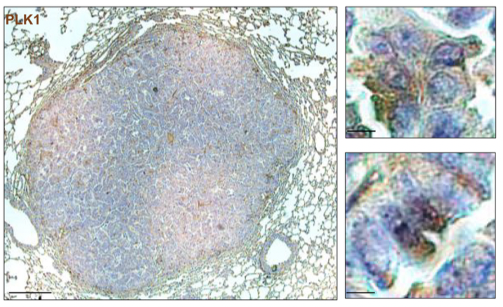 scisignal's tweet photo. Researchers have discovered a mechanism by which the kinase PLK1 fuels the growth of #LungCancer tumors through RET and #MAPKsignaling—and identifies a combination of approved drugs that can suppress these tumors in mice. @universityofky https://t.co/x3pO412Fwe https://t.co/EyZIpjNmHF
