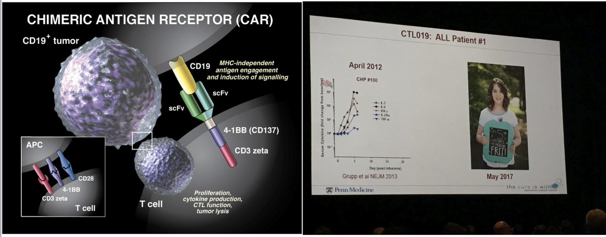 Satyayadav__'s tweet photo. @purwarrahul2  @DrGauravNarula  have started India’s CAR T-cell journey 

#APBMT22 #CARTcell therapy @IsbmtU 

From #EmilyWhitehead 1st patient to be treated by this amazing new therapy to present era - a decade long journey started at #CHOP 

@GruppSteve  #CarlJune https://t.co/9uuncRMRd4