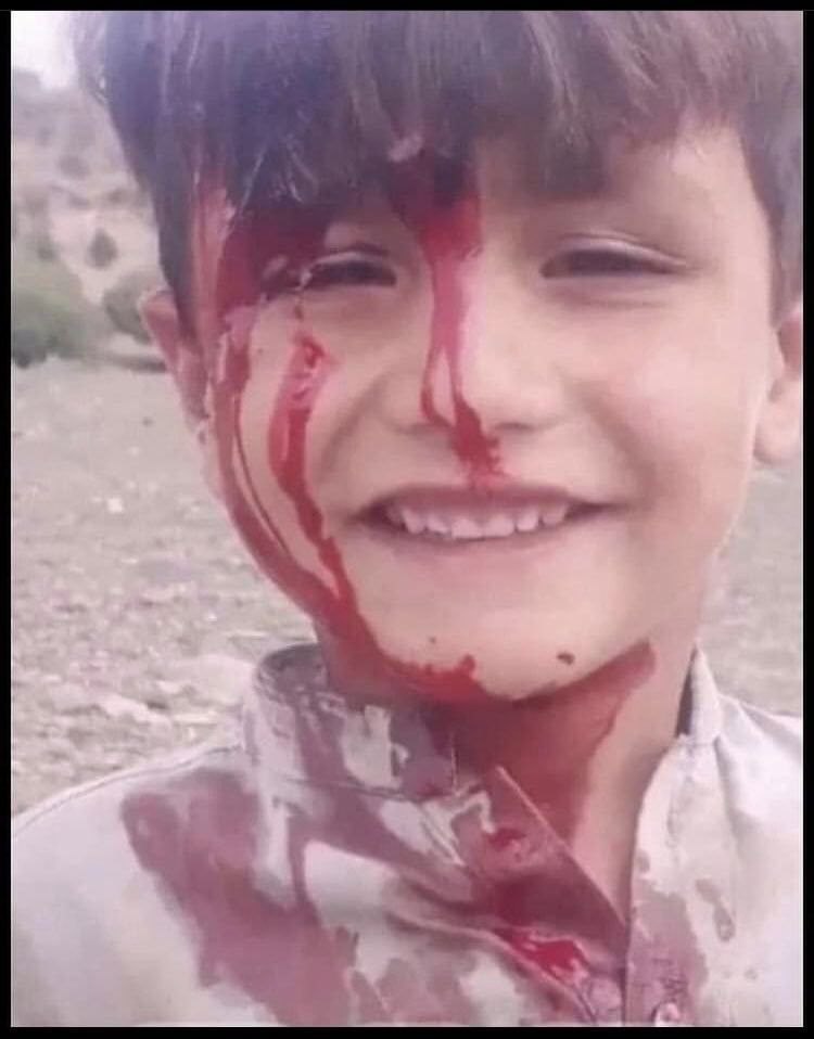 Amir_wanted81's tweet photo. چقد این عکس امیدوار کنندس، کودک بلوچی که غرق خونه، اما میخنده :)
#مهسا_امینی
#MahsaAmini
#نیکا_شاکرمی https://t.co/RtMN3op0y6
