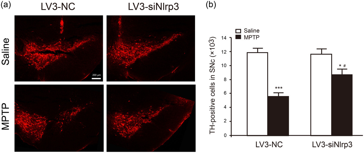 ScienceofPD's tweet photo. Researchers present lentiviral-based NLRP3 knockdown in a MPTP model of #Parkinsons (in vitro &amp; vivo); Inhibition of the inflammasome in the substantia nigra significantly reduces dopamine neuronal loss &amp; microglia activation
https://t.co/Q7OQMUDndP https://t.co/CbkhZoG2s1