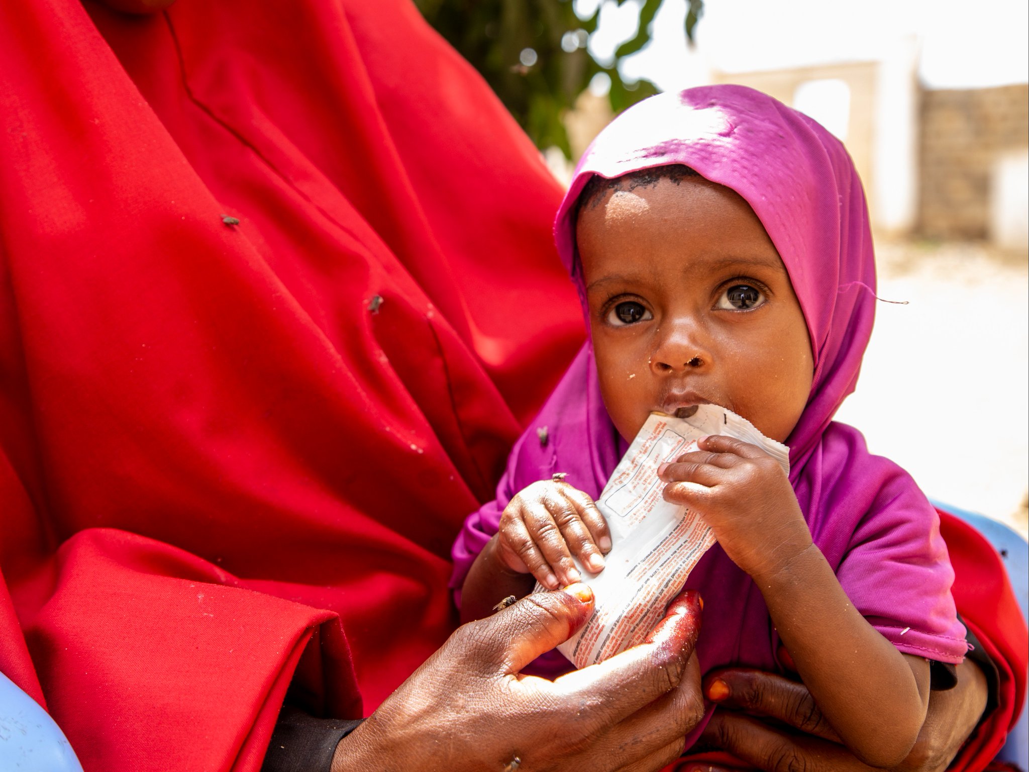 World Vision USA On Twitter The Senate s Passage Of The Global short-term-incidence-of-protein-energy-malnutrition-is-insufficient-to