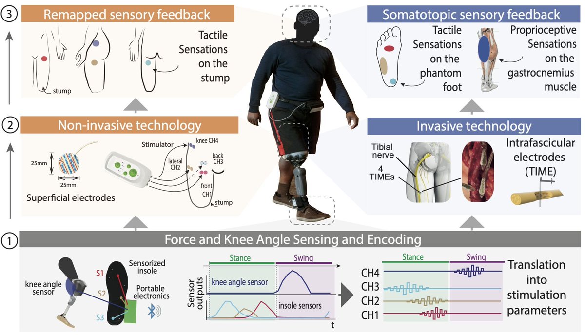 giacomo_valle's tweet photo. Here our new publication out on @SciReports titled "Cognitive benefits of using non‑invasive compared to implantable #neuralfeedback" in transfemoral #amputees. 🦿 🧠
LINK: https://t.co/ciqhgGAJvW
Thanks to LaurenChee @SRaspopovic @PreatoniGreta https://t.co/gUNW2gqqWH