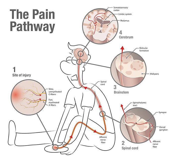 Innov_Medicine's tweet photo. A nice diagram of the pain pathway https://t.co/47HMu1AzIG