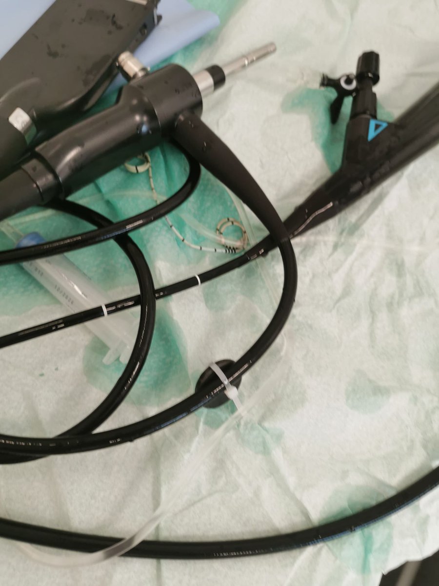 Want to Know what Stent Removal after Kidney Transplant is like? 
I've done my best to explain it here. (From a male perspective)

Spoiler alert: A few months later It's funny and nothing to worry much about. 

ryanowenchild.com/2022/10/the-tr…

#kidney #kidneytransplant <a href="/nkf/">National Kidney Foundation</a> <a href="/kidneydoc101/">Prof Liz B 🇬🇧🇮🇱🇺🇦🇵🇸</a>