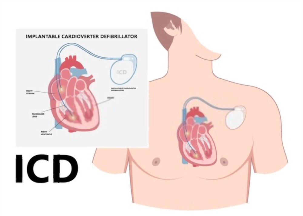 Austinw9523's tweet photo. #CardiovascularMedicine2023
Submit abstract at:https://t.co/V6vGrEbMpU
#Cardiology #pacemakertherapy #Conference #Broncos #Russ https://t.co/ZJNgKRAASQ