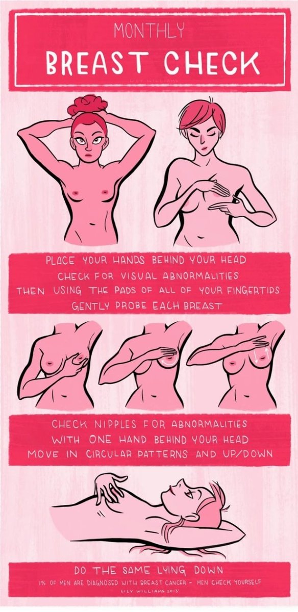 ManikkageYasuni's tweet image. October - Breast cancer awareness

1. Most common cancer in women.

2. Self examination of breasts - a Must.
If u notice a lump or even a change in the breast - go see a doctor. 
even if recent mammogram -Normal

3. Early detection &amp;amp; new treatment methods hv increased survival.