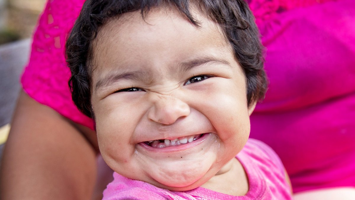 OpSmileUK's tweet photo. Just look at all these wonderful new smiles! 🤩 What better day than #WorldSmileDay to celebrate the hundreds of thousands of children, with #cleftconditions whose lives have been changed forever?! Thanks to you, we've been transforming smiles and lives for 4 decades! #CleftCare https://t.co/xR2BletWhn
