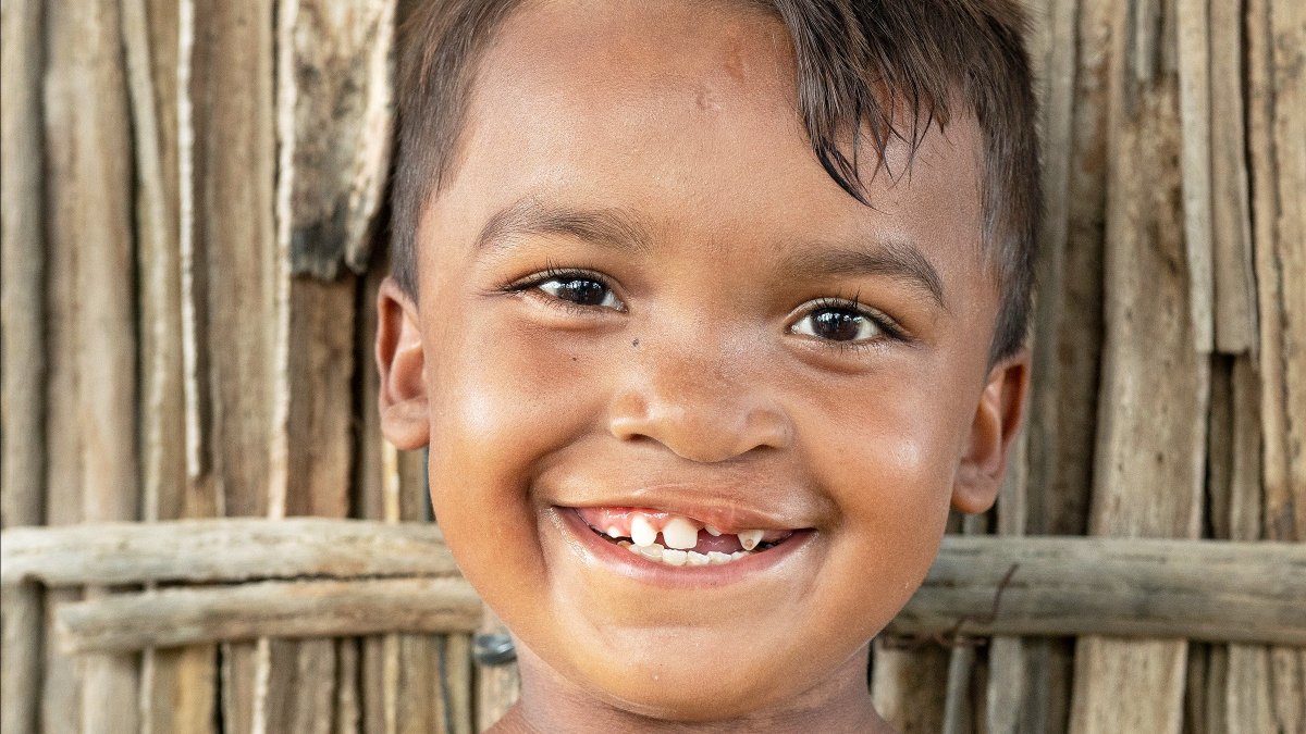 OpSmileUK's tweet photo. Just look at all these wonderful new smiles! 🤩 What better day than #WorldSmileDay to celebrate the hundreds of thousands of children, with #cleftconditions whose lives have been changed forever?! Thanks to you, we've been transforming smiles and lives for 4 decades! #CleftCare https://t.co/xR2BletWhn