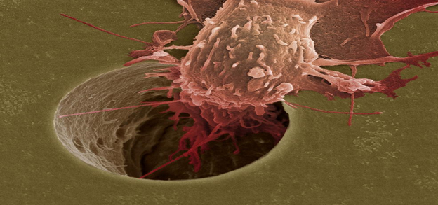 CancerEditor's tweet image. Journal of Cancer and Metastasis Research 
Recently we are working on the new article 
#Cannulated and #Metamorphosed-Renal Cell #Carcinoma
Journal pulsus.com/journal-cancer…
submission: pulsus.com/submissions/ca…