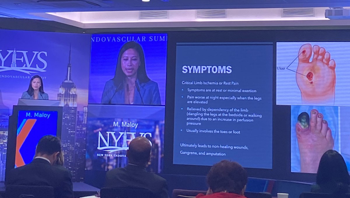 Loved hearing our colleague Marichu review those at risk for #PVD and the symptoms they experience <a href="/EndovascularNy/">NY Endovascular Summit</a> <a href="/BethOliverVP/">Beth Oliver</a> #Nursingconference #NurseLearning