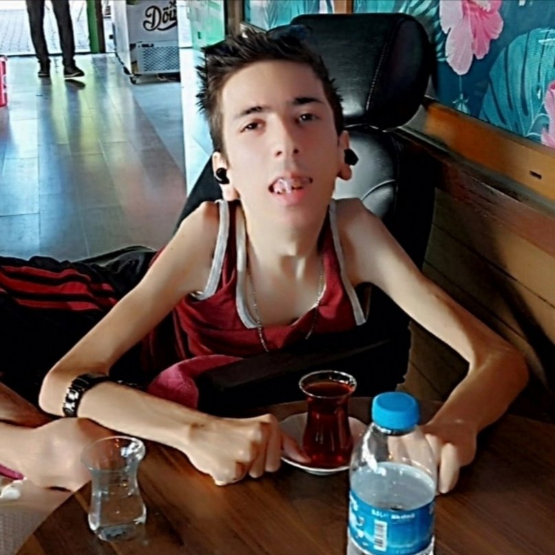 Herşeyi zamana bırakıyoz zamanımız var gibi yaşa gitsin insan kusursuz hayat sorunsuz olmaz herkes kaderini yaşar insan ölür insanlık ölmesin ben murat 23 yaşındayım koca dünyada küçük bi ilçede yaşıyom vazgeçme vazgeçen kaybeder umut hep var hastalığım sabrı öğretti 🥰