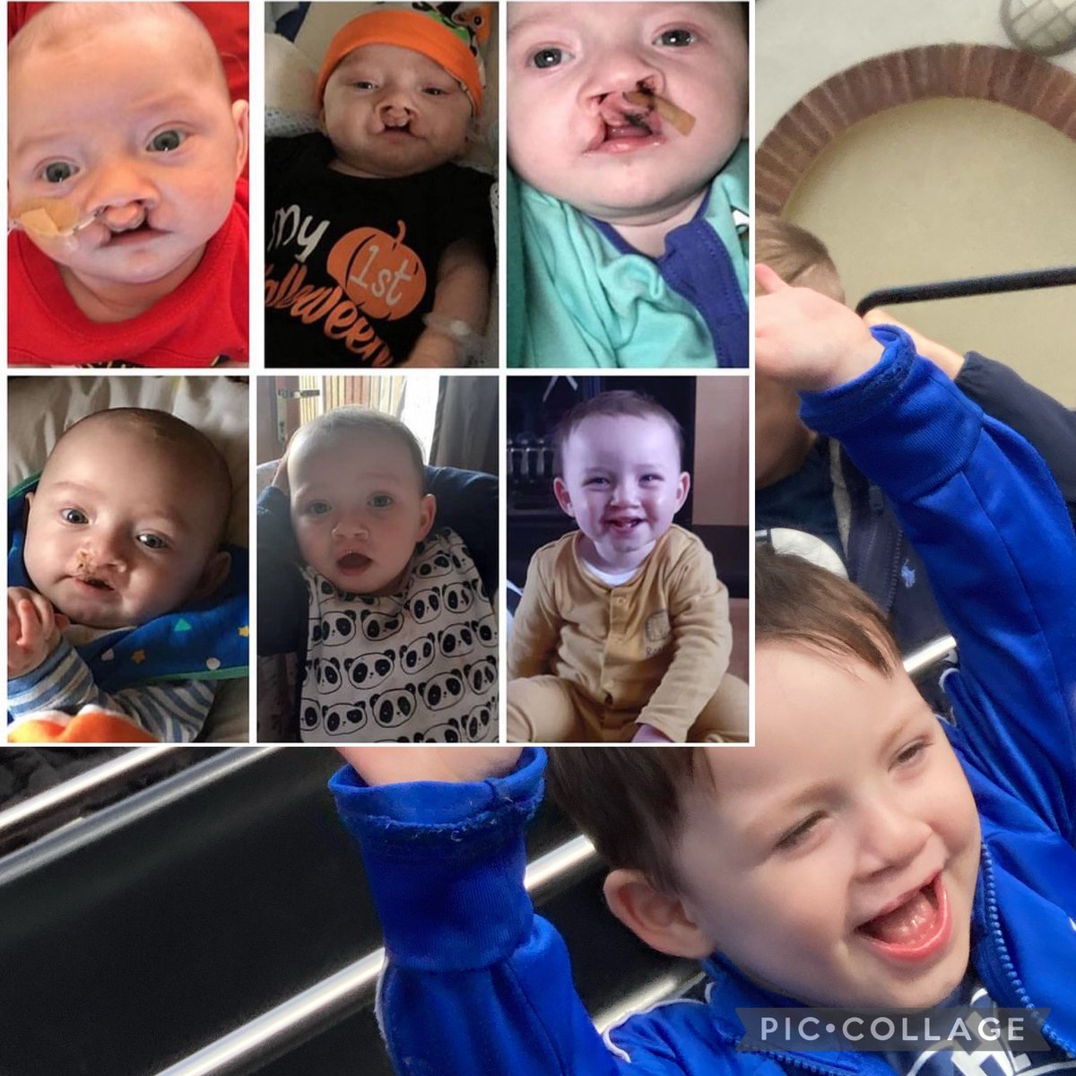 beccanolan69's tweet photo. #WorldSmileDay #myhero #cleft #firstsmile #foreversmile #happy #smileday #smile https://t.co/rn408Hlbgy