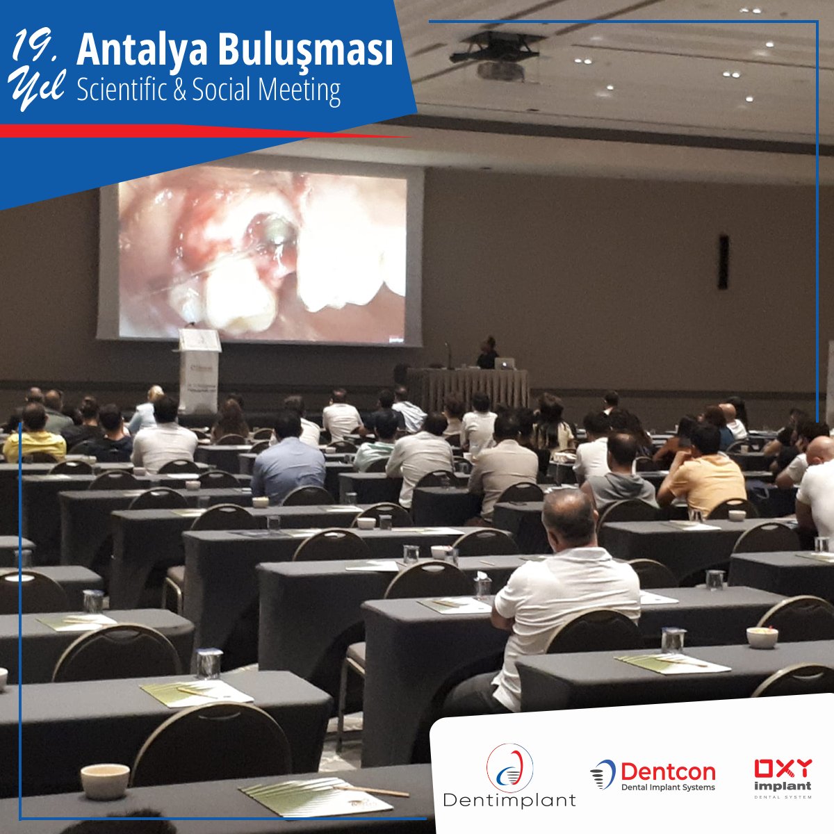 DentconImplant's tweet photo. We continue... 👩‍🔬👨‍🔬

#Dentimplant #Oxyimplant #dentcon #antalyabuluşması #kemer https://t.co/GtOlo0U7xO