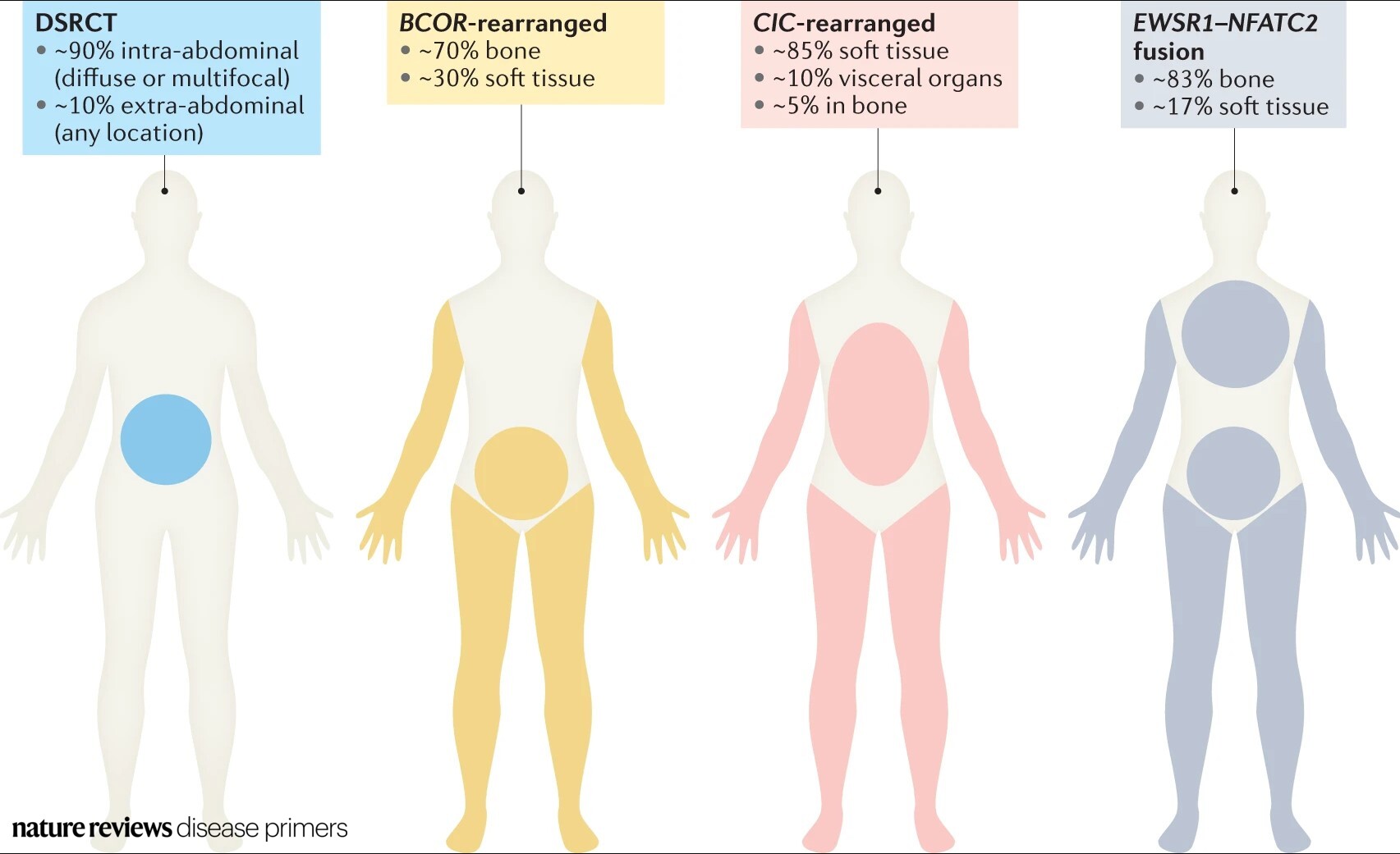 Sarcoma uterino esperanza de vida