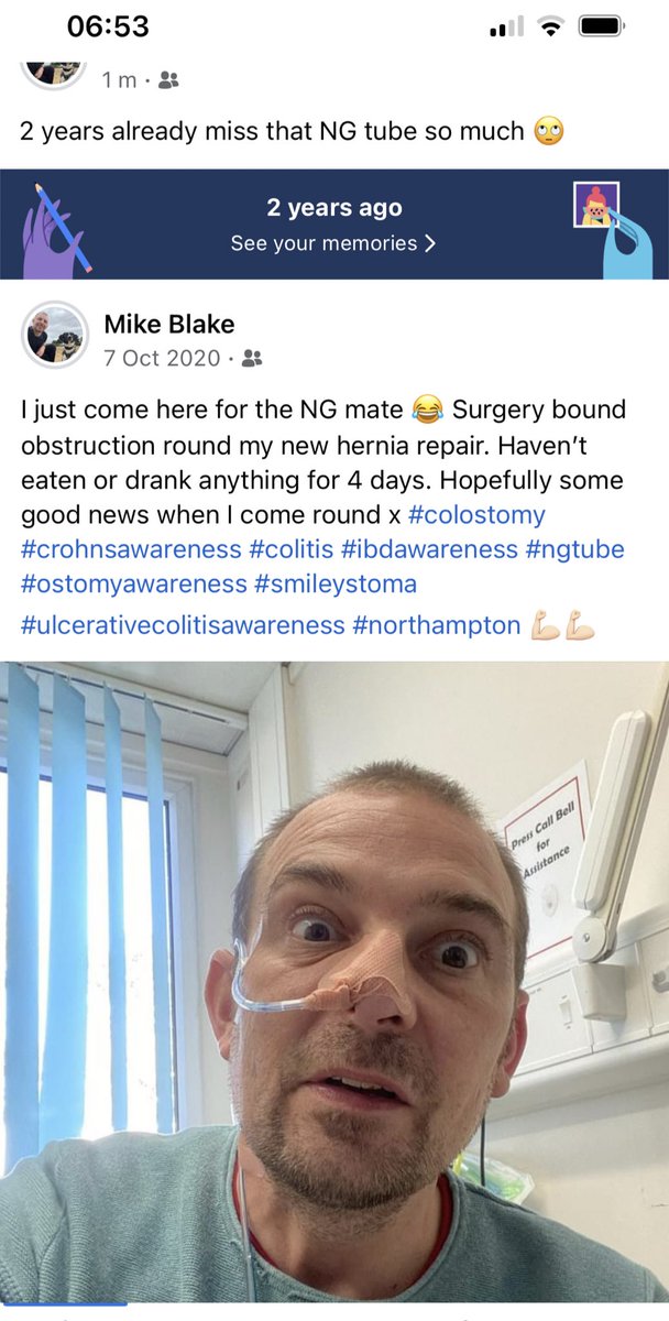 2 years today emergency surgery blockage due to scars and adhesions Bowel resection no lies when I came round the worst pain I’ve felt with all the surgeries I’ve had!! #bowelresection #nhs #ostomy #stoma #colostomy #crohns @NGHnhstrust #ngtube #stomaawareness