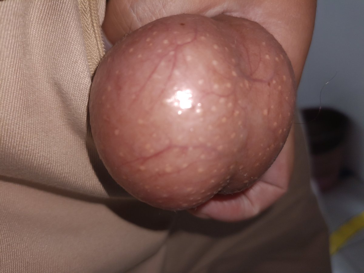 handsherm's tweet photo. #阉割 #踢蛋  #精牛 #睾丸  #CBT  #球 #爆蛋  #SM #性瘾患者   想咬一口么😉 https://t.co/latJUtAKrW