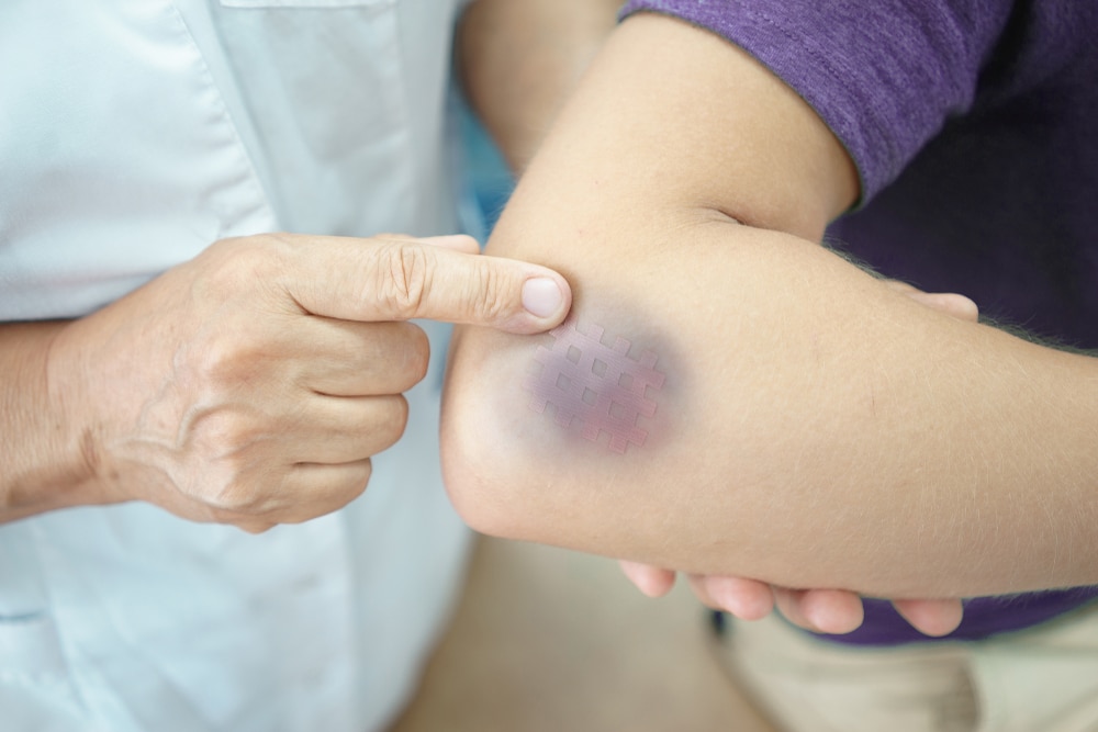 Call 4 Injury InjuredCallToday.com (@AccidentNetwork) / Posts / X
