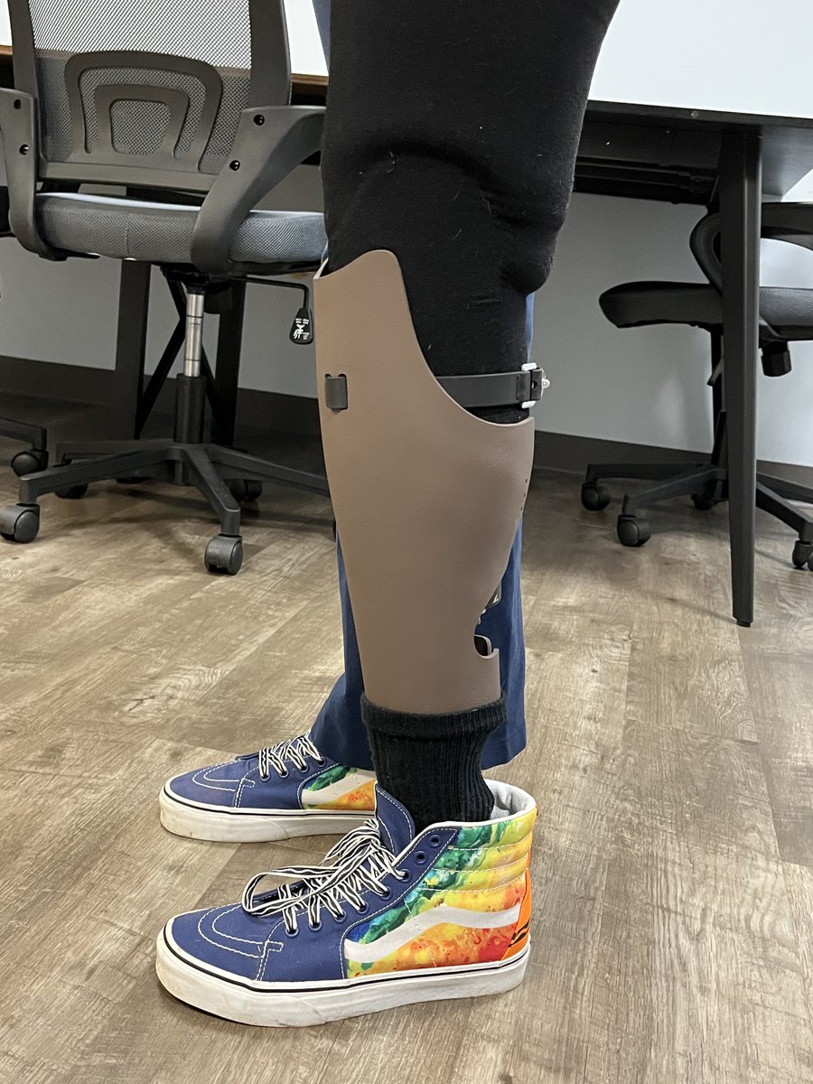 Allied_OP's tweet photo. AlliedOP Patient Karissa added an Alleles cover to her BK prosthesis #FabricationFriday 

Karissa see’s Practitioner Michael at our West Orange, NJ location📍

🦿 @_WillowWood limblogic vacuum pump and @FreedomInnovate  Agilix foot https://t.co/jg7PW5p7xg