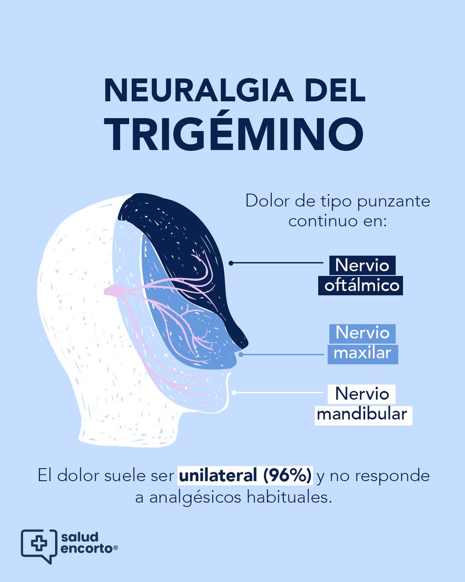 saludencorto's tweet image. Dí internacional de la #NeuralgiaDelTrigémino conoce esta enfermedad⬇️