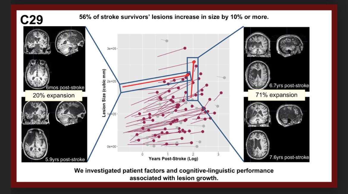 lisajohnsnorris's tweet photo. Presenting some new work where we investigate longitudinal lesion profiles. This is a passion project that I’m excited to share! Come join me shortly at C29 to geek out with me.  #snl2022 @SNLmtg https://t.co/o8tIUa4Gic