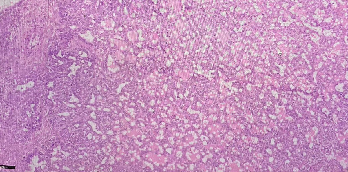 BAGPGynPath's tweet photo. BAGP Long course 2022: Dr Baljeet Kaur lecture & slide seminar on Germ cell tumours #Surgpath #BAGP #PathTwitter #gynaepath #patholog https://t.co/KJFff2GGuT