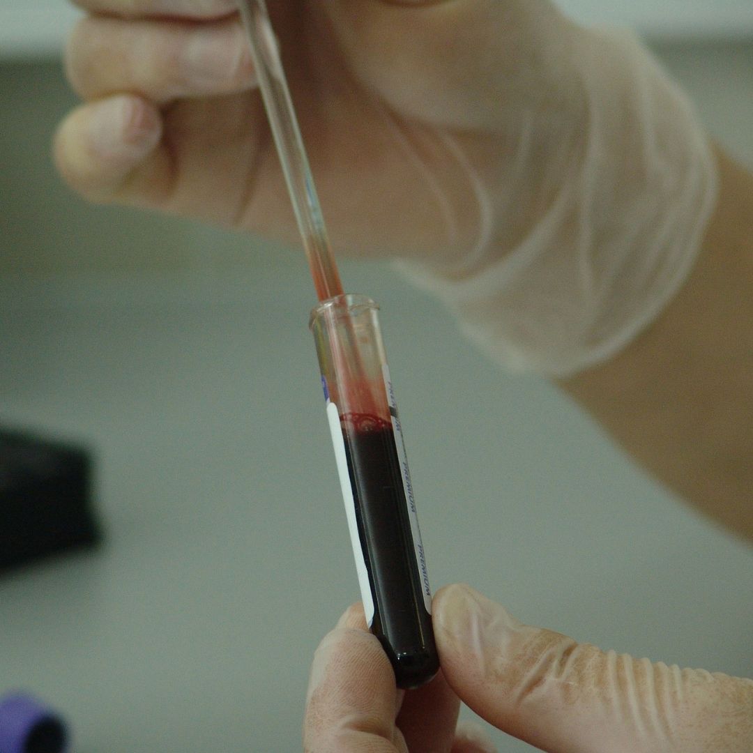 PrenatalGenlab's tweet photo. If you are a mother-to-be, you may have a few questions regarding a prenatal paternity test. This article will provide answers to some common questions related to this type of testing.

Learn More: https://t.co/tZEcDnaL2M

#prenatalpaternitytest #nipt #nippt https://t.co/otb9QyoCNk