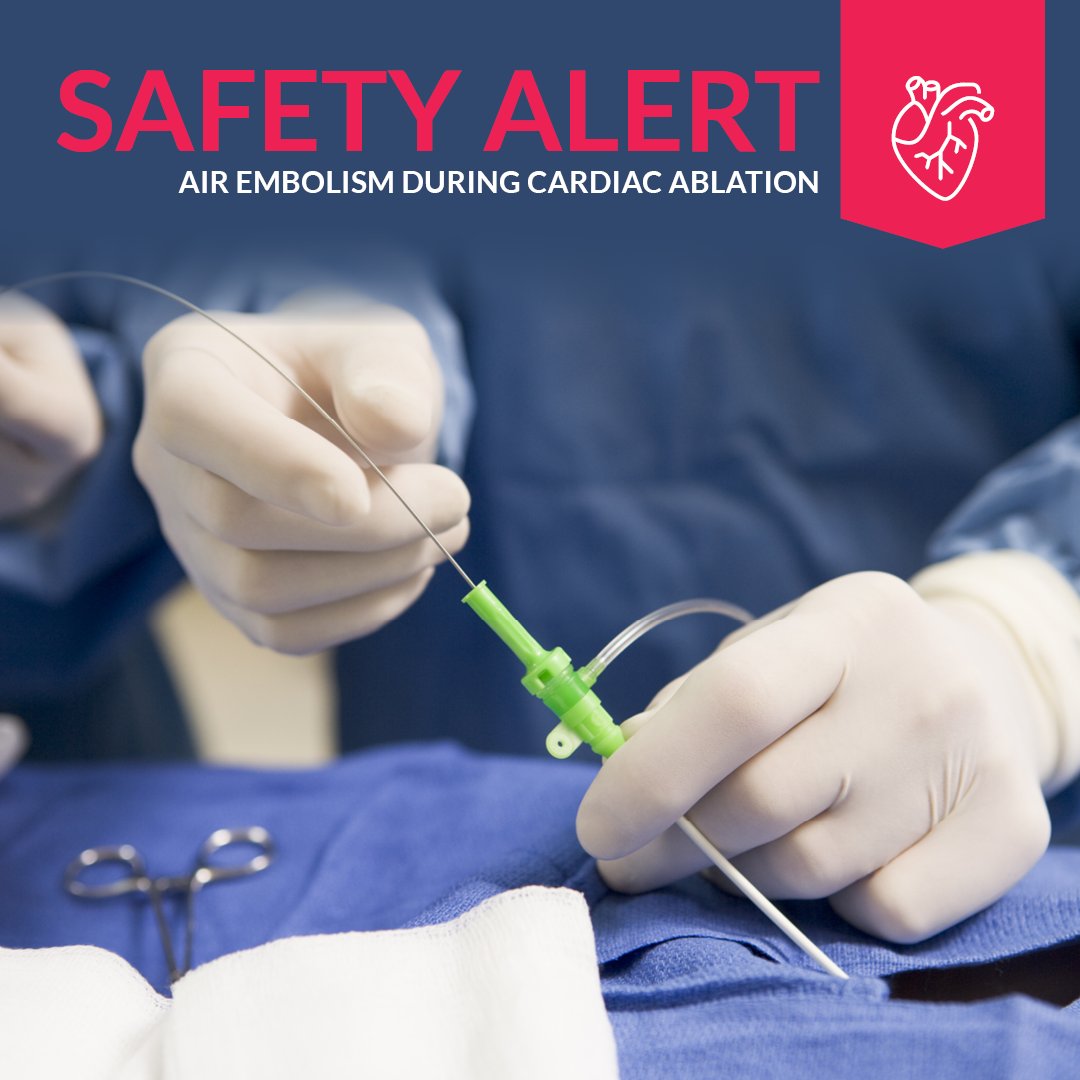 ⚠️𝗦𝗮𝗳𝗲𝘁𝘆 𝗔𝗹𝗲𝗿𝘁: 𝗔𝗶𝗿 𝗘𝗺𝗯𝗼𝗹𝗶𝘀𝗺 𝗗𝘂𝗿𝗶𝗻𝗴 𝗖𝗮𝗿𝗱𝗶𝗮𝗰 𝗔𝗯𝗹𝗮𝘁𝗶𝗼𝗻
During a cardiac ablation procedure, the catheter irrigation fluid bag emptied and was replaced by staff. While priming the tubing, air was noted in the tube, and (1/7)