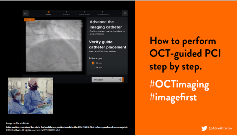 AbbottCardio's tweet photo. 11/11 Check out more insights from LightLab in the webinars and presentations at https://t.co/G6fypHZtSX
Tune in next Friday ⏰ to learn how to perform OCT-guided PCI via short PCI live case videos.
#OCTimaging #imagefirst #imagelast https://t.co/tngl7IpOTm