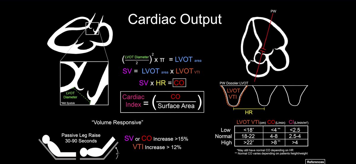 dan___kim's tweet photo. Advanced #echo cards from @ACEP_EUS critical care subcommittee on assessing LV ejection fraction and cardiac output
#echofirst #pocus 
https://t.co/LhO8RuQpRE https://t.co/sDyrYgZoSM