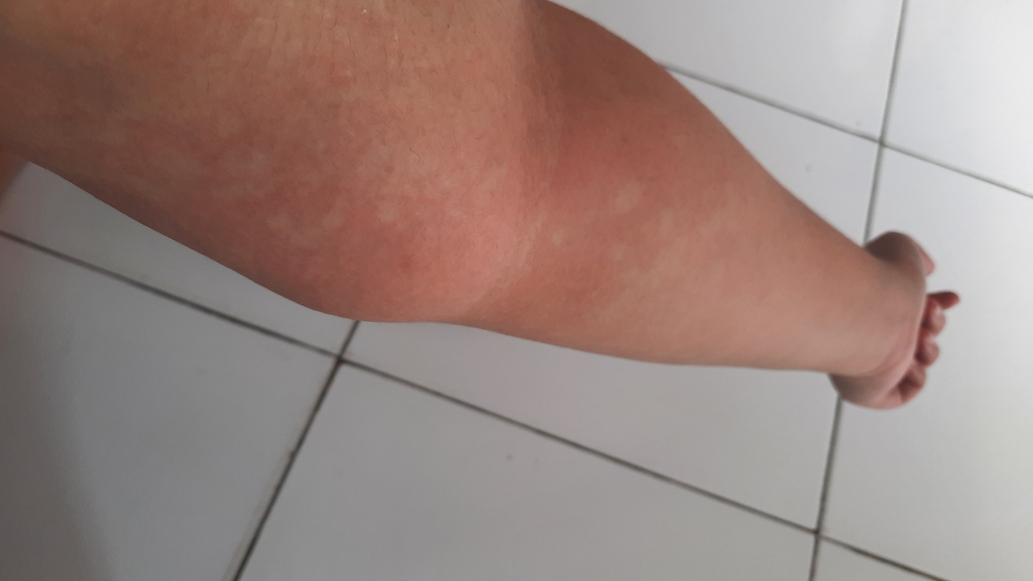 put'sᗢ on Twitter "gue kalo ngomong alergi ga bisa minum amer tuh beneran alergi ya anjir gue