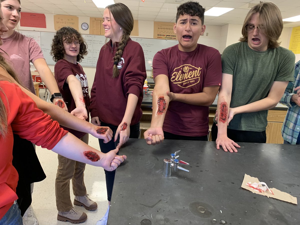 rbwhitey's tweet photo. Anatomy class can be treacherous sometimes! @OTCedu @RSWolves #woundlab https://t.co/0Y6tqxHodH
