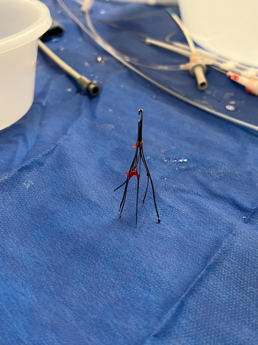 danaparkr's tweet photo. Great case to finish off my IR rotation @VIRDelaware #filteroutfriday https://t.co/gWEGTNQGzI