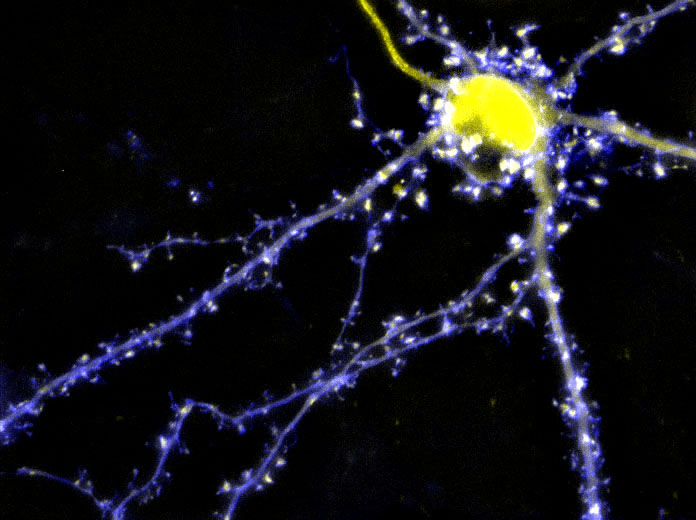 Dell'Acqua Lab (@labacqua) on Twitter photo A postdoctoral position is available in <a href="/LabAcqua/">Dell'Acqua Lab</a> <a href="/CUPharmacology/">CU Pharmacology</a> Research will employ sophisticated fluorescence imaging approaches to study regulation of kinase and phosphatase signaling complexes required for synaptic plasticity. Contact mark.dellacqua@cuanschutz.edu A postdoctoral position is available in <a href="/LabAcqua/">Dell'Acqua Lab</a> <a href="/CUPharmacology/">CU Pharmacology</a> Research will employ sophisticated fluorescence imaging approaches to study regulation of kinase and phosphatase signaling complexes required for synaptic plasticity. Contact mark.dellacqua@cuanschutz.edu