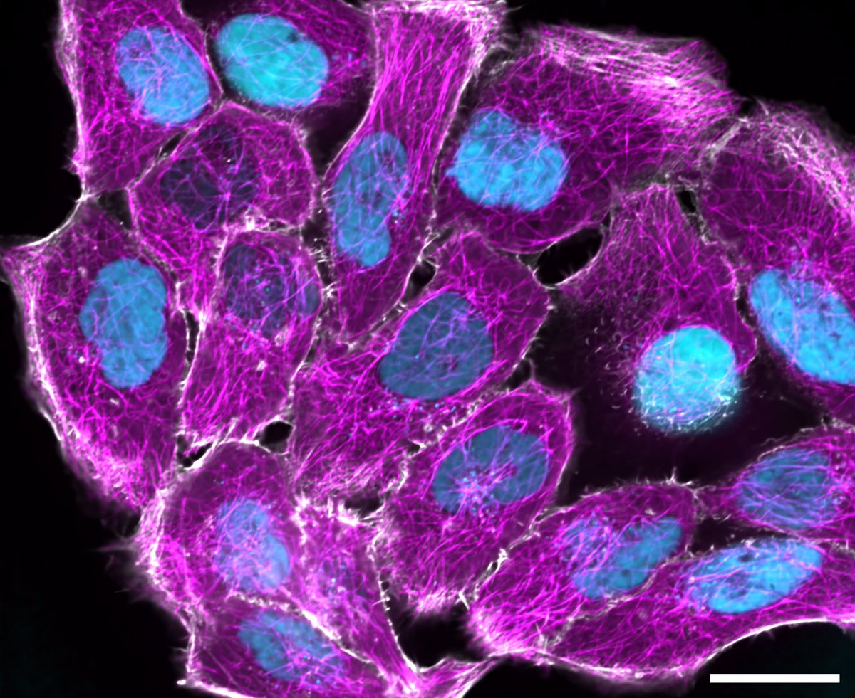 fspasqualini's tweet photo. #FluorescenceFriday from @LabPhysiology's @MelissaPezzotti @moisesdisante @eloisa_torchia and myself. Dual #HaCaT reporter line for #actin and #tubulin (Nuclei in false-colors to hide our current research project). @NikonInst @CrestOptics @Okolabgroup @Photometrics @ibidiCells https://t.co/4oP4KXgrAE