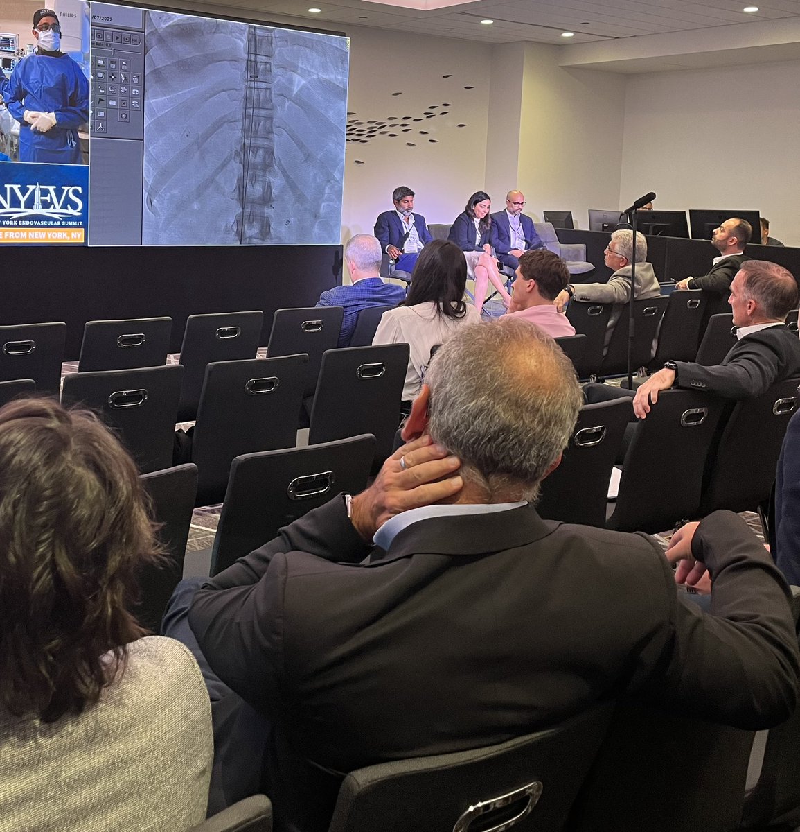 Mount Sinai IR (@mountsinaiir) on Twitter photo LIVE <a href="/EndovascularNy/">NY Endovascular Summit</a> Bilateral renal vein and IVC thrombectomy LIVE case now! #ClotTriever
<a href="/RSP516/">Rahul Patel</a> <a href="/ShashiMurthyMD/">Shashi Murthy</a> <a href="/DanShilo/">Dan Shilo</a> #DVT #NYEVS2022 LIVE <a href="/EndovascularNy/">NY Endovascular Summit</a> Bilateral renal vein and IVC thrombectomy LIVE case now! #ClotTriever
<a href="/RSP516/">Rahul Patel</a> <a href="/ShashiMurthyMD/">Shashi Murthy</a> <a href="/DanShilo/">Dan Shilo</a> #DVT #NYEVS2022