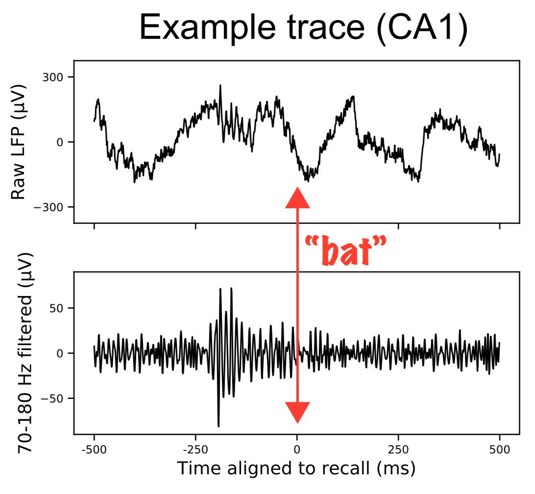 Proud to report <a href="/jjsakon/">john sakon (johnsakon @ bsky)</a>'s new paper has been published in <a href="/PNASNews/">PNASNews</a>! pnas.org/doi/10.1073/pn…
We find hippocampal--but not extrahippocampal MTL--high frequency ripples reflect the retrieval of *episodic* memories. This phenomenon is consistent with...(1/3)