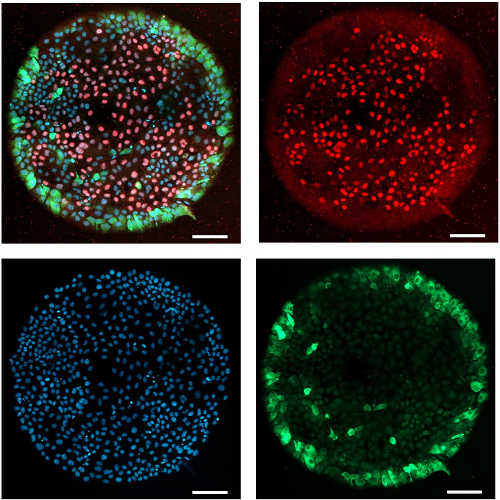 ishujain4695's tweet photo. My first first author paper is finally online! Wanna read a paper about the awesome Notch signaling and its crosstalk with mechanical forces in patterned liver differentiation - https://t.co/tCMEKED2Nd
Tune in for some cool techniques, computational modeling and fun science!(1/5) https://t.co/6Xf3L9hStg